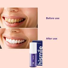 Teeth Whitening Toothpaste Kit